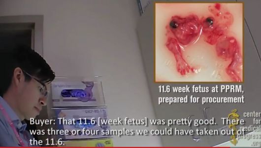 11-6-baby-aborted-planned-parenthood